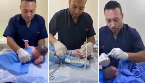 doctor save new born baby