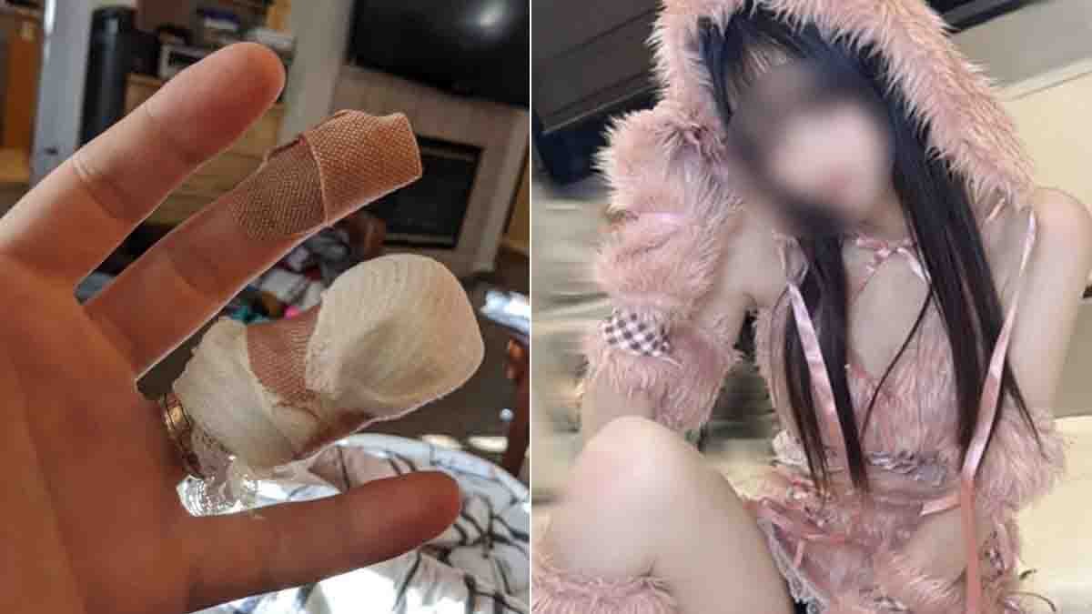 Japan woman cuts boyfriend’s finger and stores it in fridge after breakup