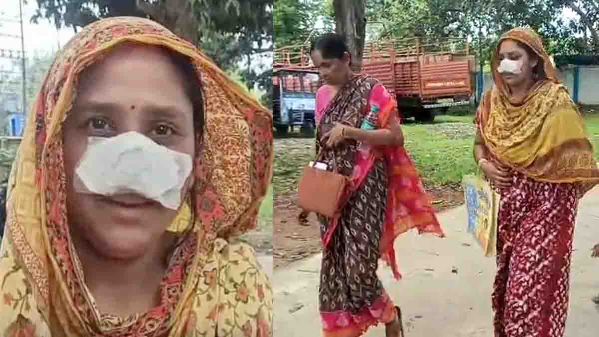West Bengal woman injured after husband bites off nose in Shantipur incident