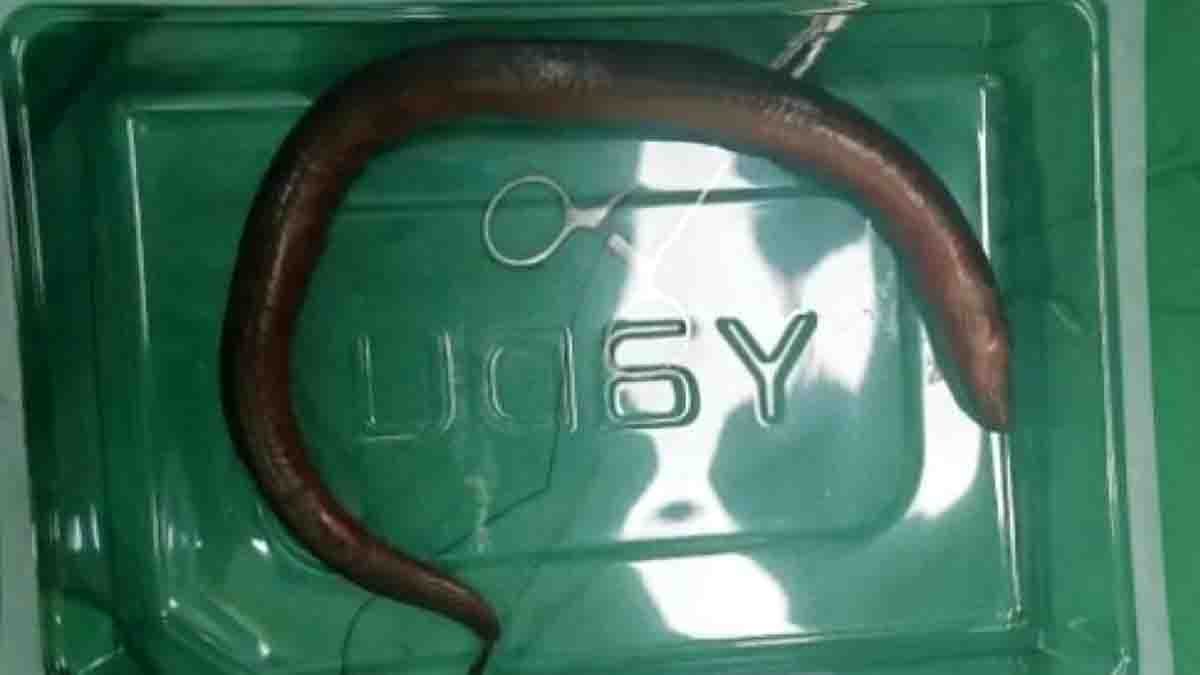 One-Foot-Long Eel Found Inside Man's Stomach in China - VIral