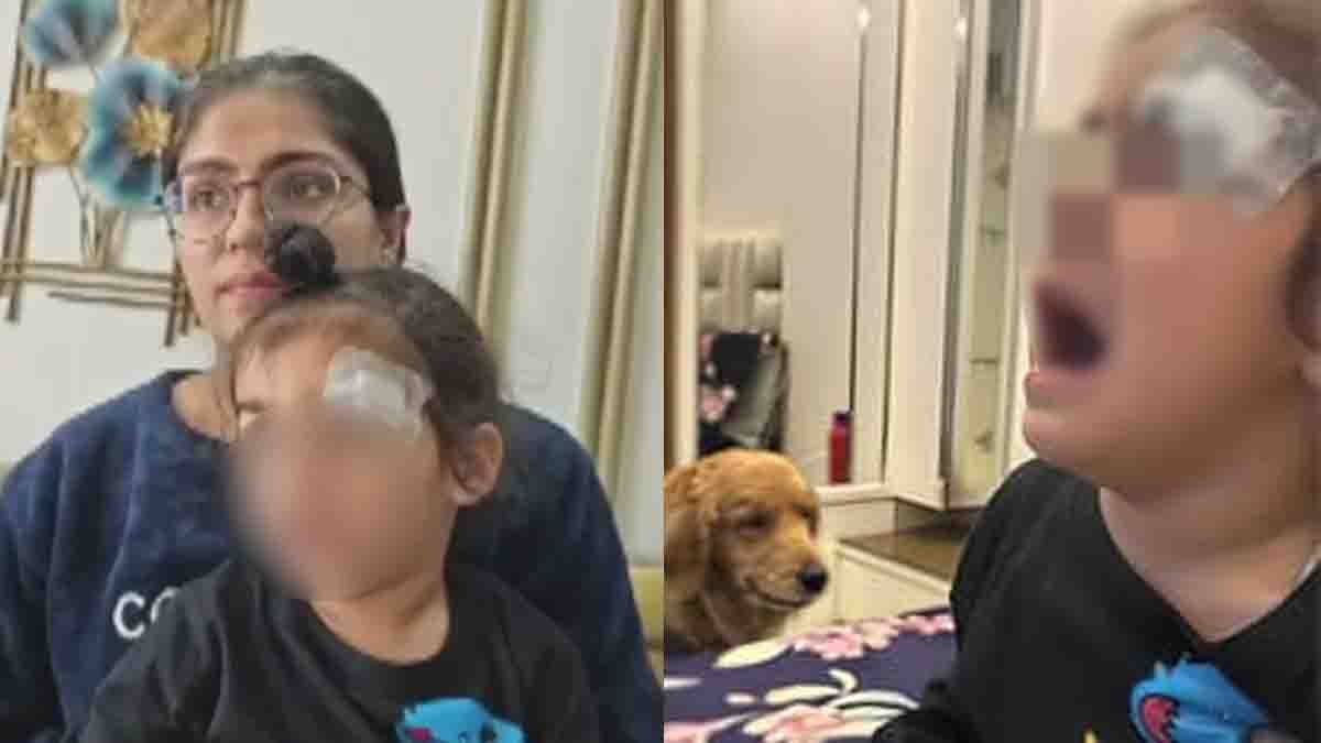 Meerut doctor applies Fevikwik instead of stitches on injured child, shocking medical negligence case in Uttar Pradesh