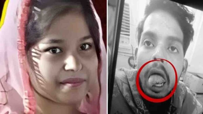 Ghaziabad Wife Bites incident where a woman bit off her husband’s tongue during a domestic dispute over Instagram reels addiction in Modi Nagar, Uttar Pradesh