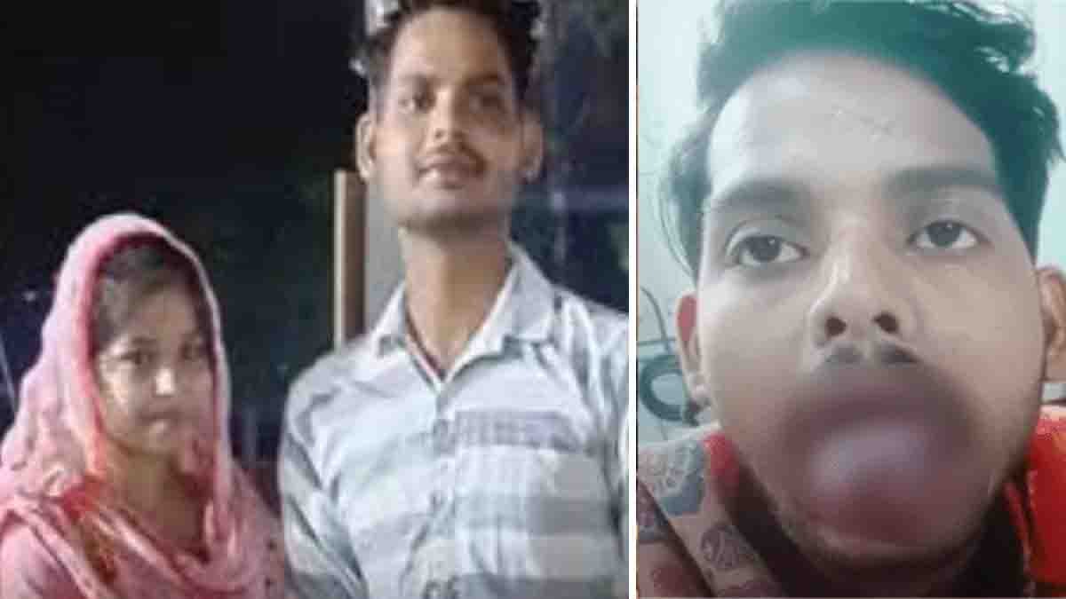 Ghaziabad Wife Bites incident where a woman bit off her husband’s tongue during a domestic dispute over Instagram reels addiction in Modi Nagar, Uttar Pradesh
