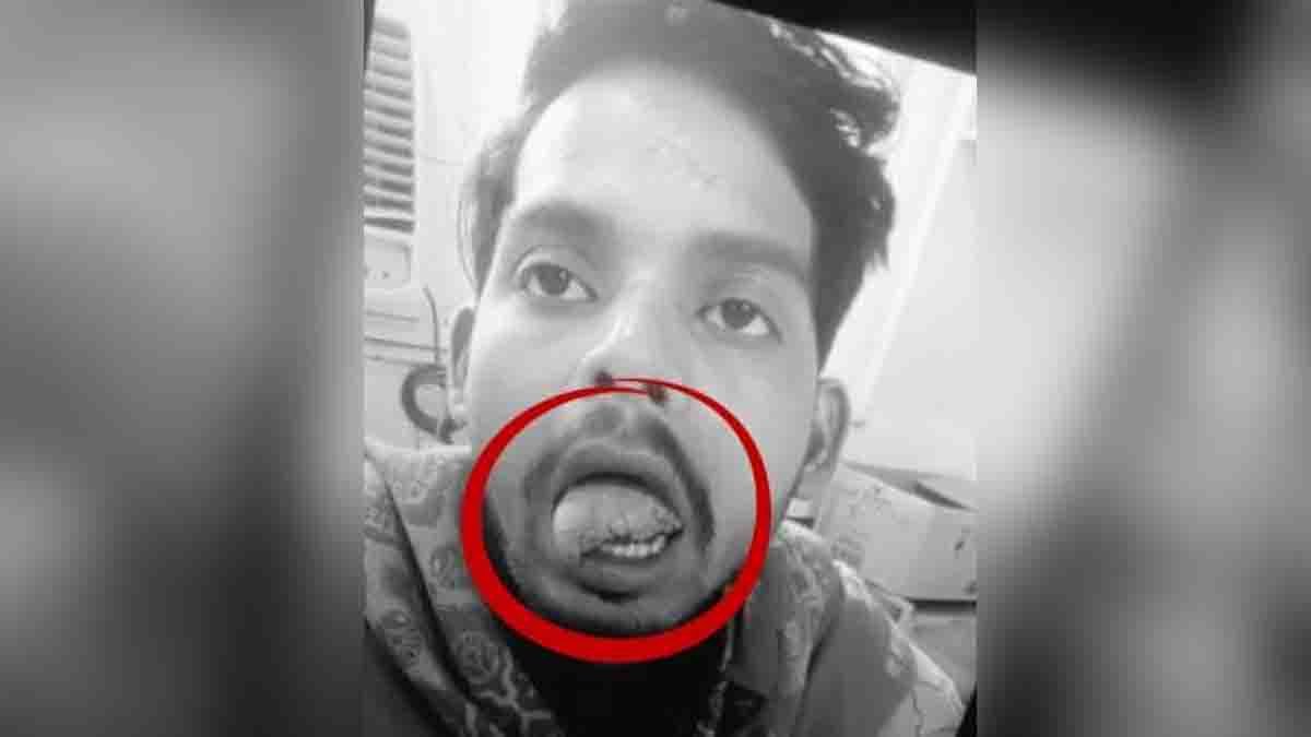 Ghaziabad Wife Bites incident where a woman bit off her husband’s tongue during a domestic dispute over Instagram reels addiction in Modi Nagar, Uttar Pradesh