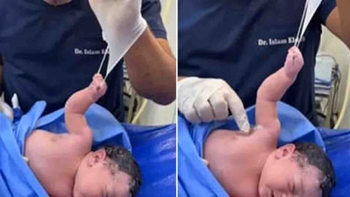 Viral video of newborn baby tightly holding doctor’s surgical glove with strong grip