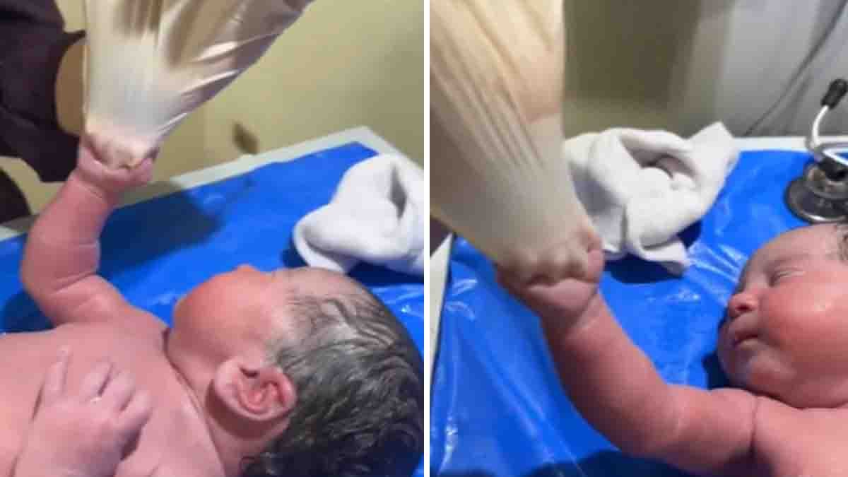 Viral video of newborn baby tightly holding doctor’s surgical glove with strong grip