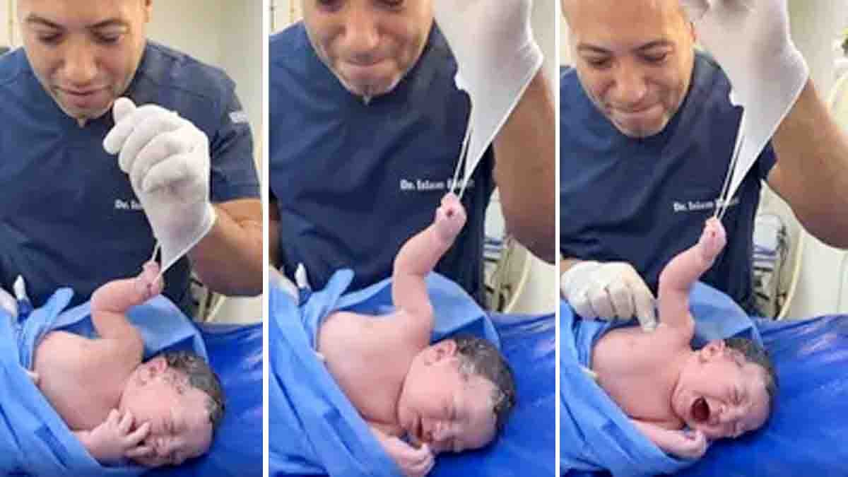 Viral video of newborn baby tightly holding doctor’s surgical glove with strong grip