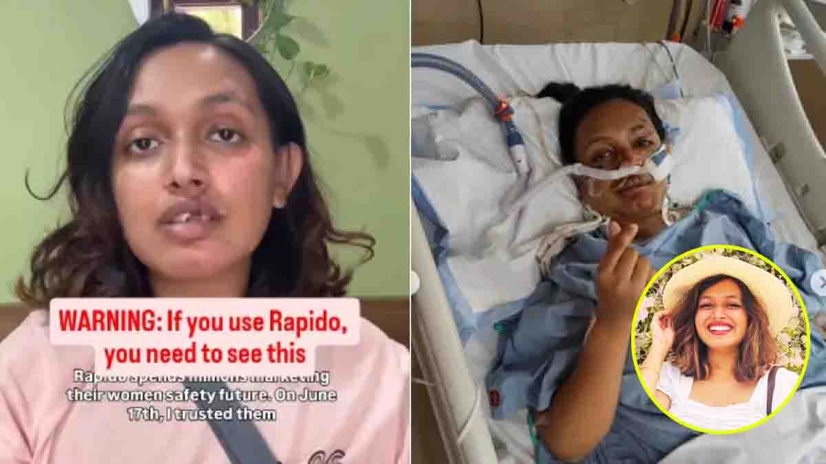 ಬೆಂಗಳೂರಿನಲ್ಲಿ ಆಘಾತಕಾರಿ ಘಟನೆ (Bengaluru Rapido Accident): ರ್ಯಾಪಿಡೋ ಬೈಕ್ ಟ್ರ್ಯಾಕ್ಟರ್ಗೆ ಡಿಕ್ಕಿ, ₹20 ಲಕ್ಷ ಪರಿಹಾರ ಕೇಳಿದ ಯುವತಿ! 16 Bengaluru Rapido Accident victim Sani Krishna alleges negligence after a bike taxi crash and seeks ₹20 lakh compensation from Rapido.