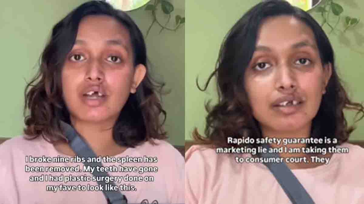 Bengaluru Rapido Accident victim Sani Krishna alleges negligence after a bike taxi crash and seeks ₹20 lakh compensation from Rapido.