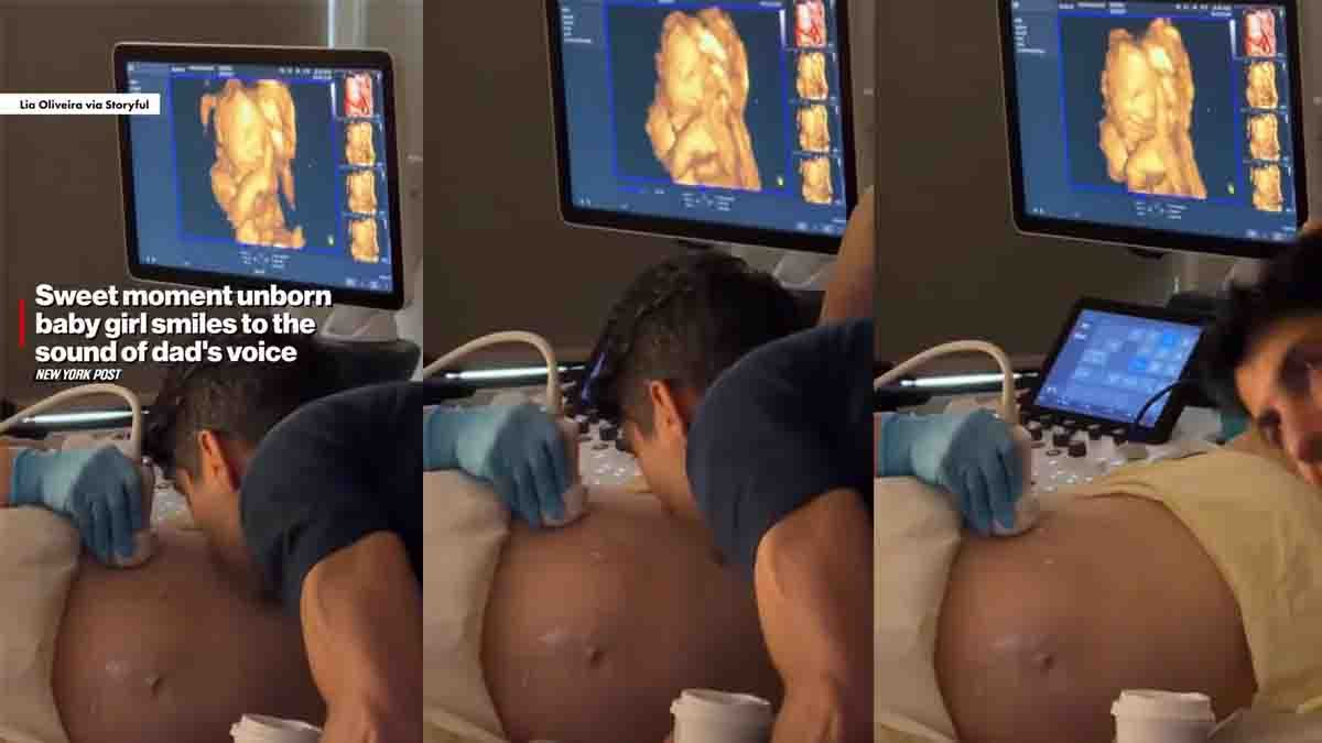 Baby Smile Viral Video showing an unborn baby smiling during an ultrasound scan after hearing the father's voice in a heartwarming moment.
