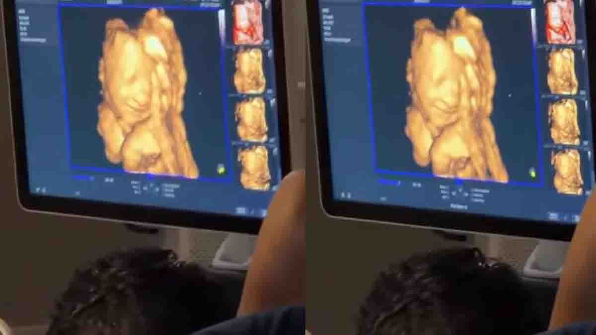 Baby Smile Viral Video showing an unborn baby smiling during an ultrasound scan after hearing the father's voice in a heartwarming moment.