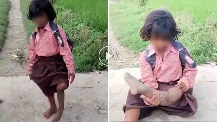 Ragini Uttar Pradesh girl who lost one leg travels to school and receives a tricycle